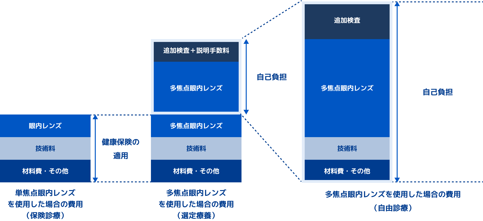 単焦点眼内レンズ
を使用した場合の費用(保険診療)、多焦点眼内レンズを使用した場合の費用(選定療養)、多焦点眼内レンズを使用した場合の費用
(自由診療)