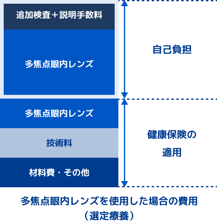 多焦点眼内レンズを使用した場合の費用(選定医療)