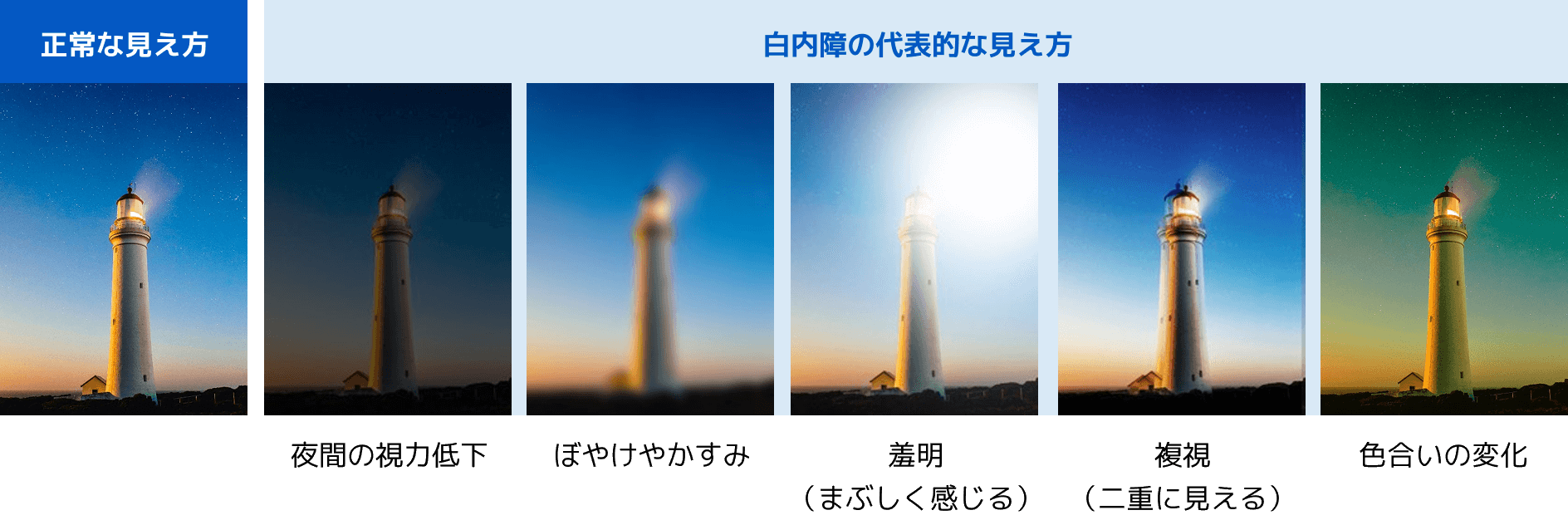 正常な見え方 白内障の代表的な見え方